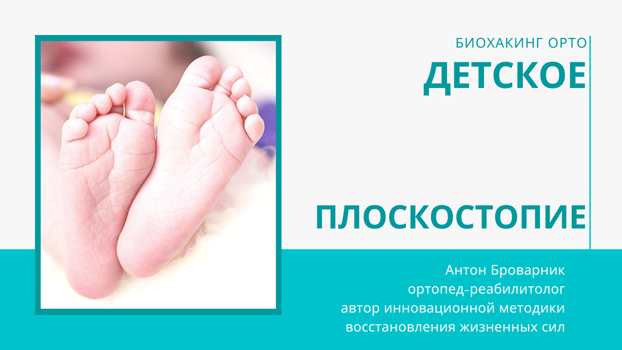 плоскостопие у детей