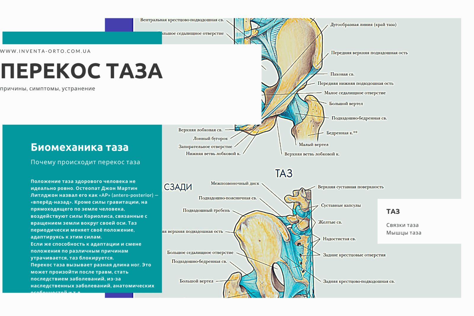 перекос таза