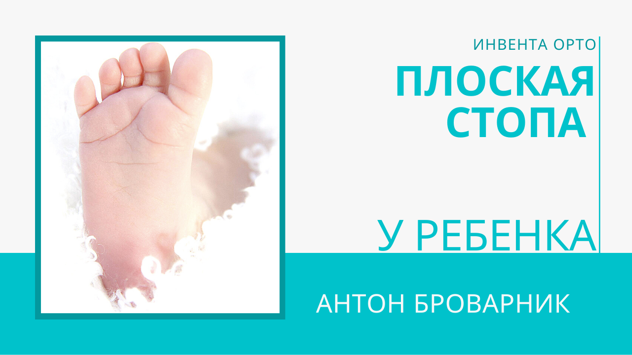 детское плоскостопие
