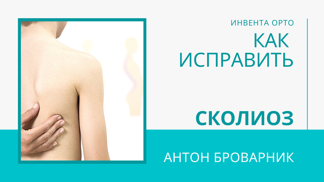 как исправить сколиоз